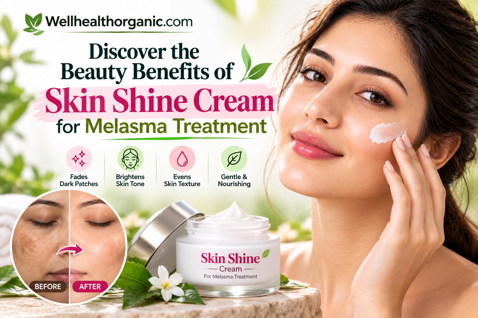 Discover the Beauty Benefits of Skin Shine Cream for Melasma Treatment